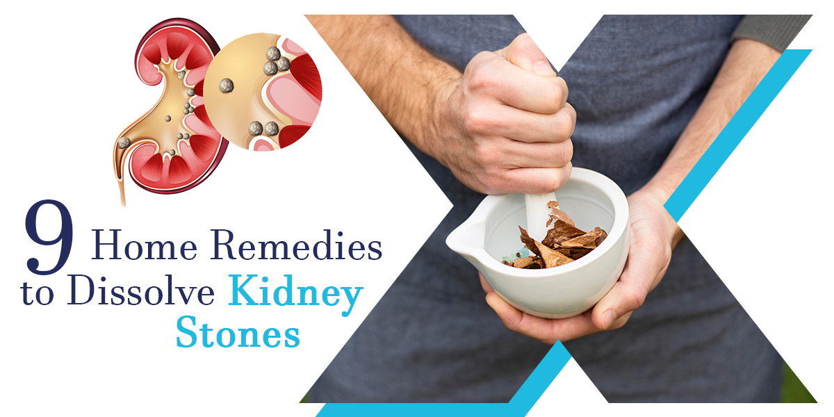 Kidney stone deals removal naturally